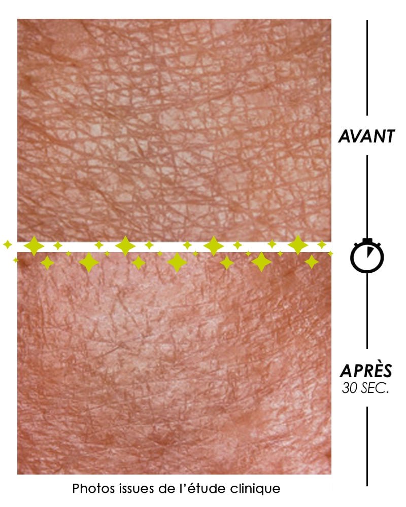 Résultat avant-après Pschitt Magique Garancia : Zoom macro sur le grain de peau affiné et lissé en seulement 30 secondes