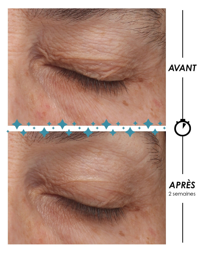 Avant-après contour des yeux anti-âge mono-expert Laboratoire Garancia