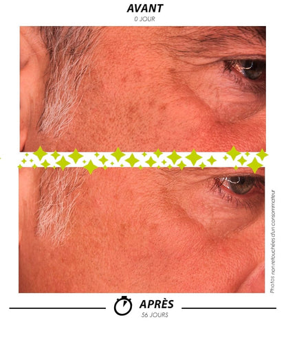 Sérum [ ÉCLAIR de LUNE L'Absolu ] de Garancia avec l'avant apres Eric