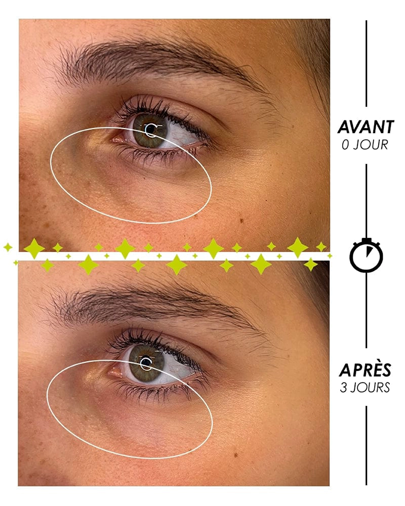 Photo avant / après du Roll-on contour des yeux multi-actions à l'efficacité ANTI-CERNES, ANTI-POCHES, ANTI-RIDES, ANTI-RELACHEMENT, HYDRATANTS, ANTI-FATIGUE.