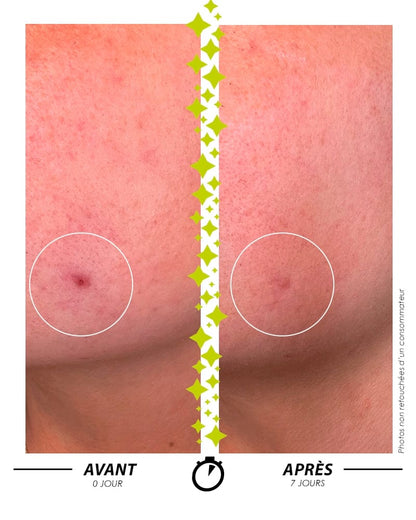 avant-après elixir