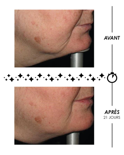 Étoile du Jour - Crème riche rose suprême volumatrice