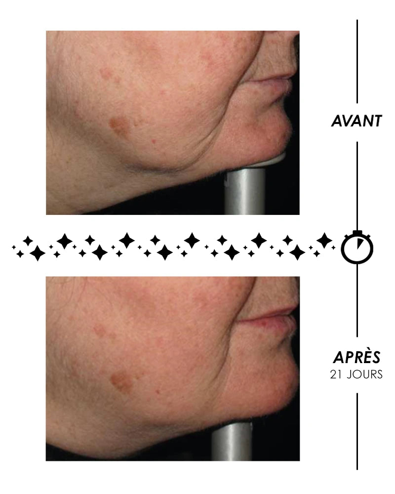 Étoile du Jour - Crème riche rose suprême volumatrice