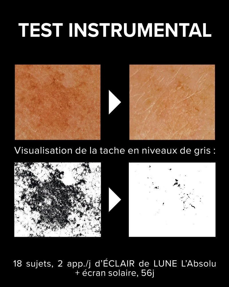 Éclair de Lune L'Absolu - Sérum anti-taches