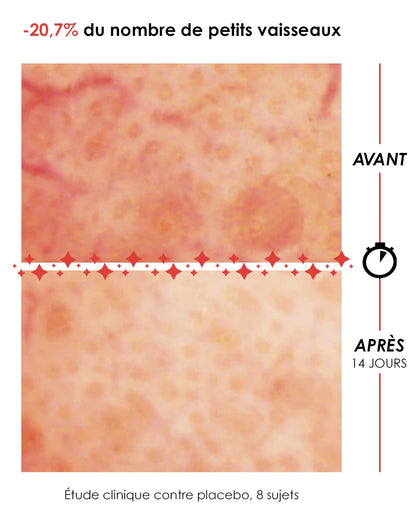 Make My Redness Disappear Serum