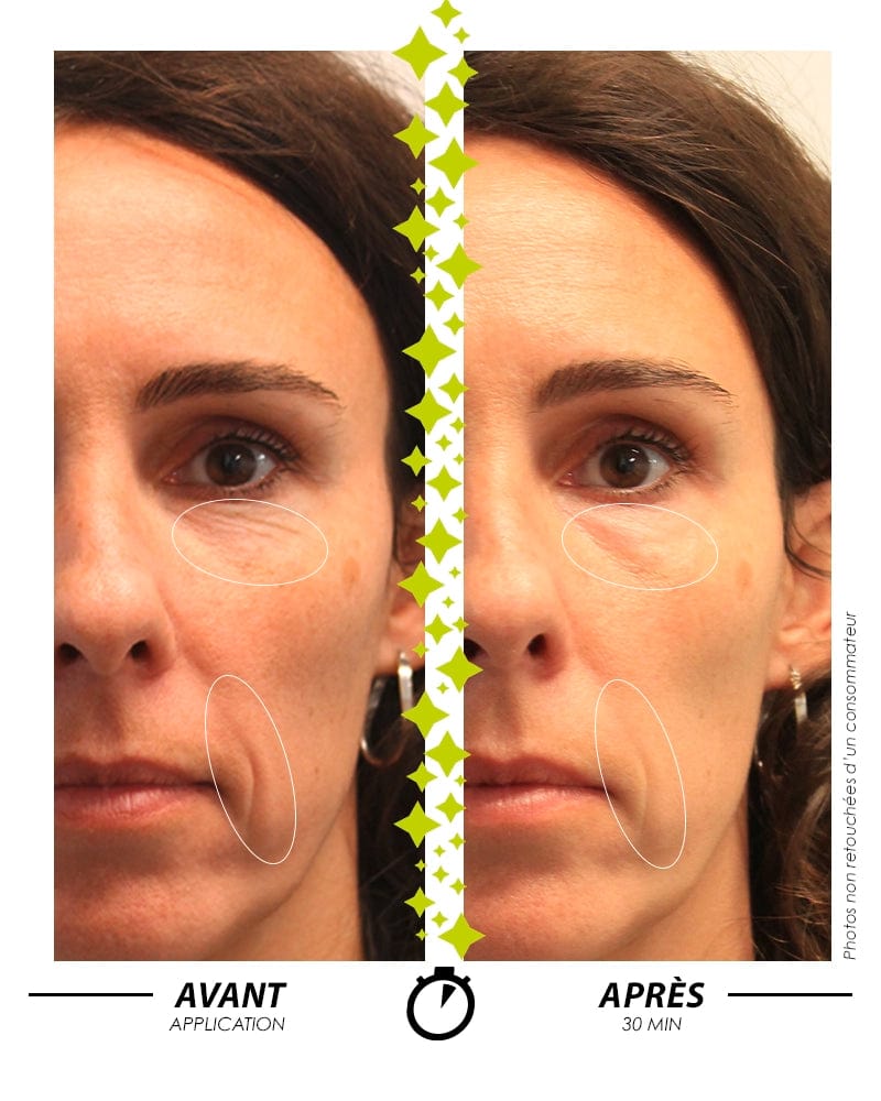 Laboratoire Garancia Anti-Âge & Anti-Rides [ MYSTÉRIEUX Repulpant ]. Comparaison sur visage avant et après application