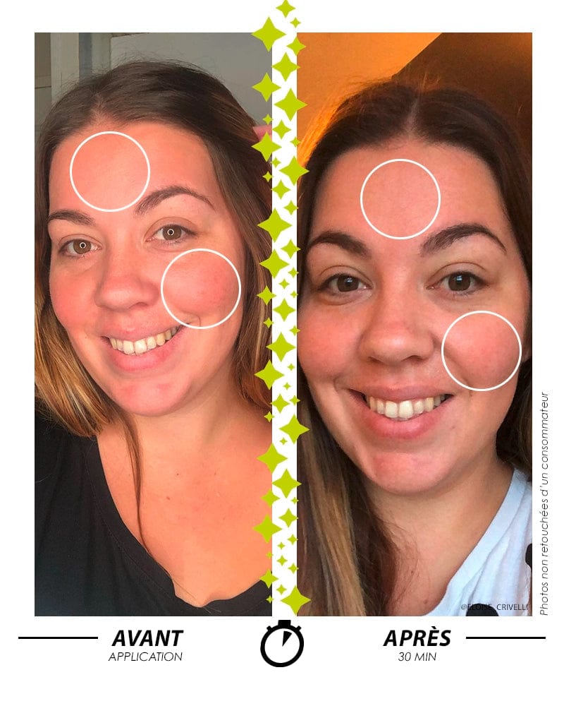  Comparatif avant/après application d'un soin Garancia : réduction visible des rougeurs sur les joues et le front seulement 30 minutes après l'application. Photos non retouchées d'une consommatrice.