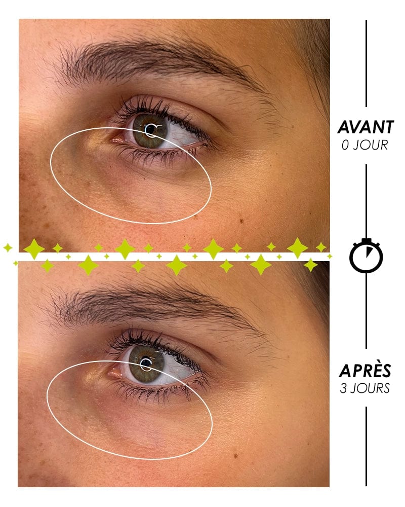 Laboratoire Garancia Contour des yeux LARMES de FANTÔME