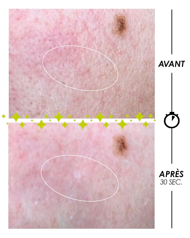 Laboratoire Garancia Micropeeling sans grain Pschitt Magique Nouvelle Peau Édition Limitée Psychédélique 2023 avant/après