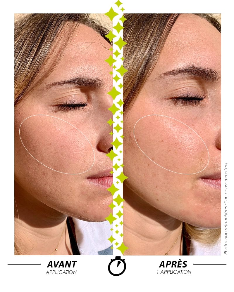 Laboratoire Garancia Sérum L'Appel de la Forêt - image d'un visage avant application du sérum et après application