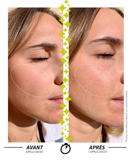 Laboratoire Garancia Sérum L'Appel de la Forêt - image d'un visage avant application du sérum et après application