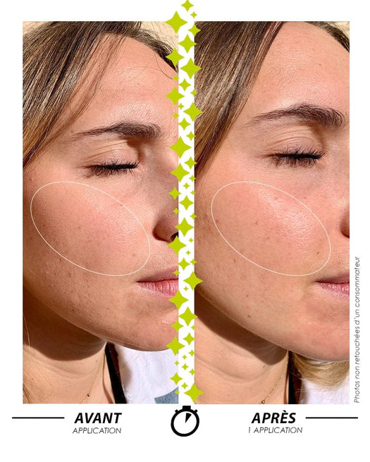 Laboratoire Garancia Sérum [ L'APPEL de la FORÊT ] SÉRUM DOUBLE PHASE - visage d'une femme avant et après application du sérum